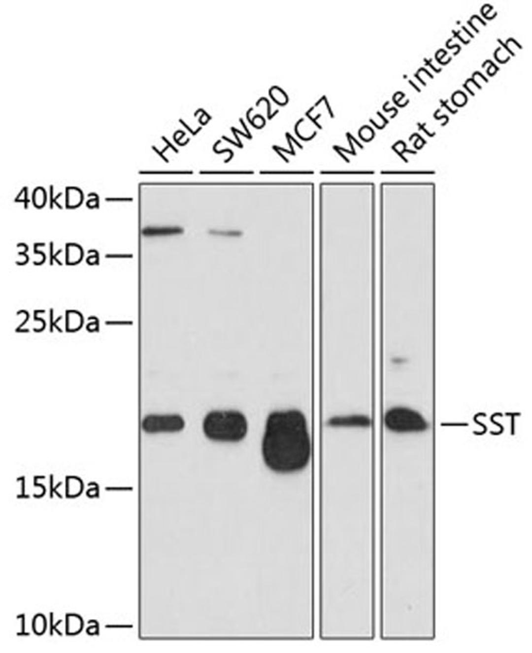 Western blot - SST antibody (A9274)