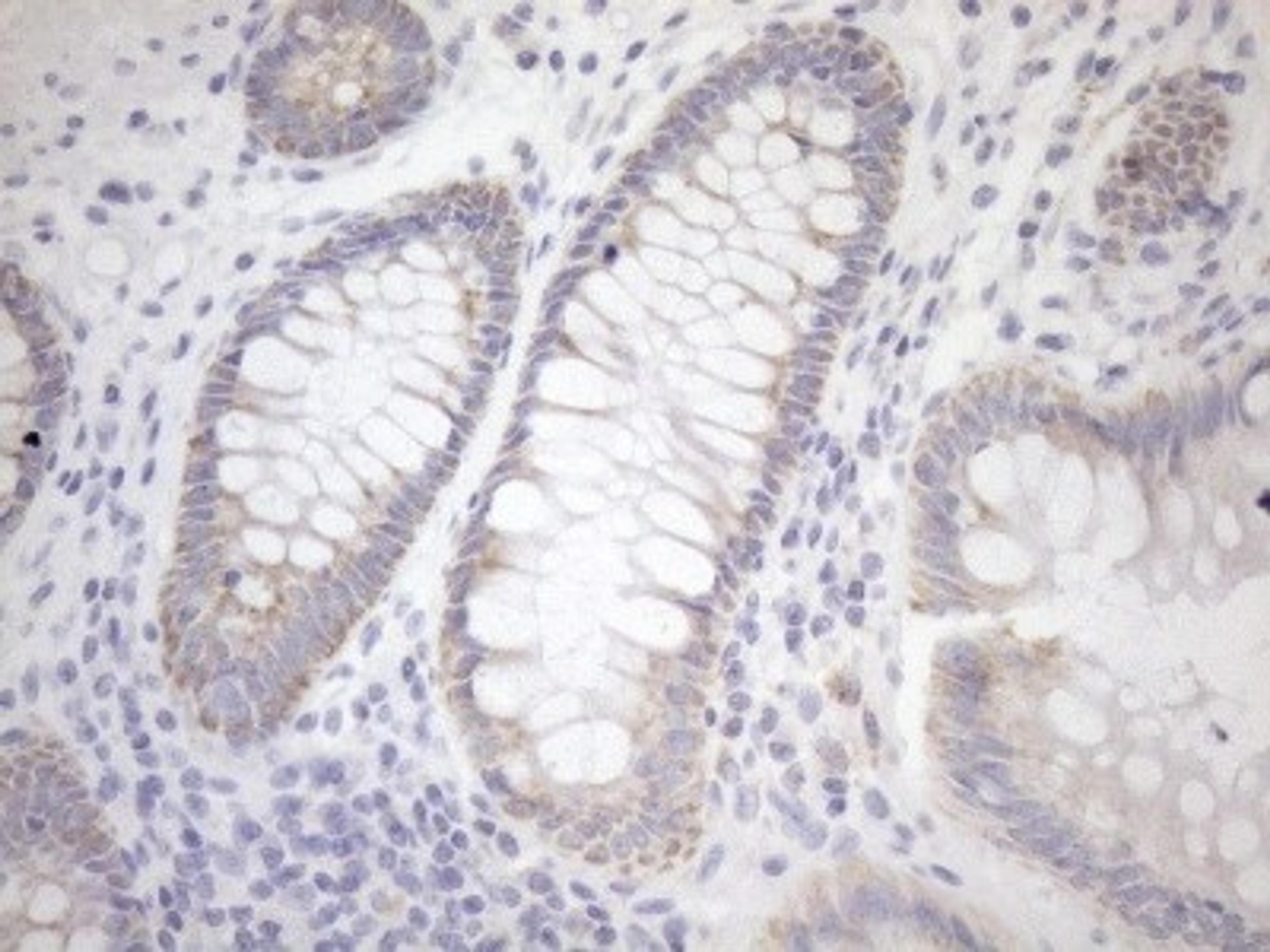 Immunohistochemistry: Cyclophilin-F Antibody (1G8) [NBP2-45380] - Analysis of Human colon tissue. (Heat-induced epitope retrieval by 1mM EDTA in 10mM Tris buffer (pH8.5) at 120C for 3 min)