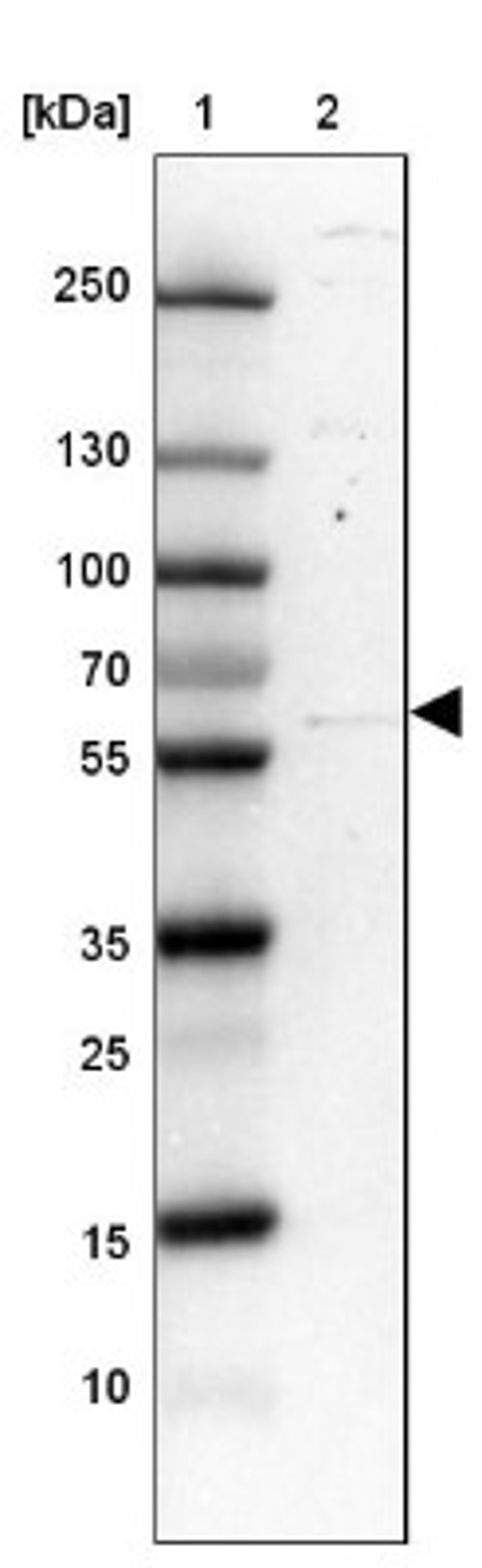 Western Blot: TRIM35 Antibody [NBP1-81733] - Lane 1: Marker [kDa] 250, 130, 100, 70, 55, 35, 25, 15, 10<br/>Lane 2: Tonsil