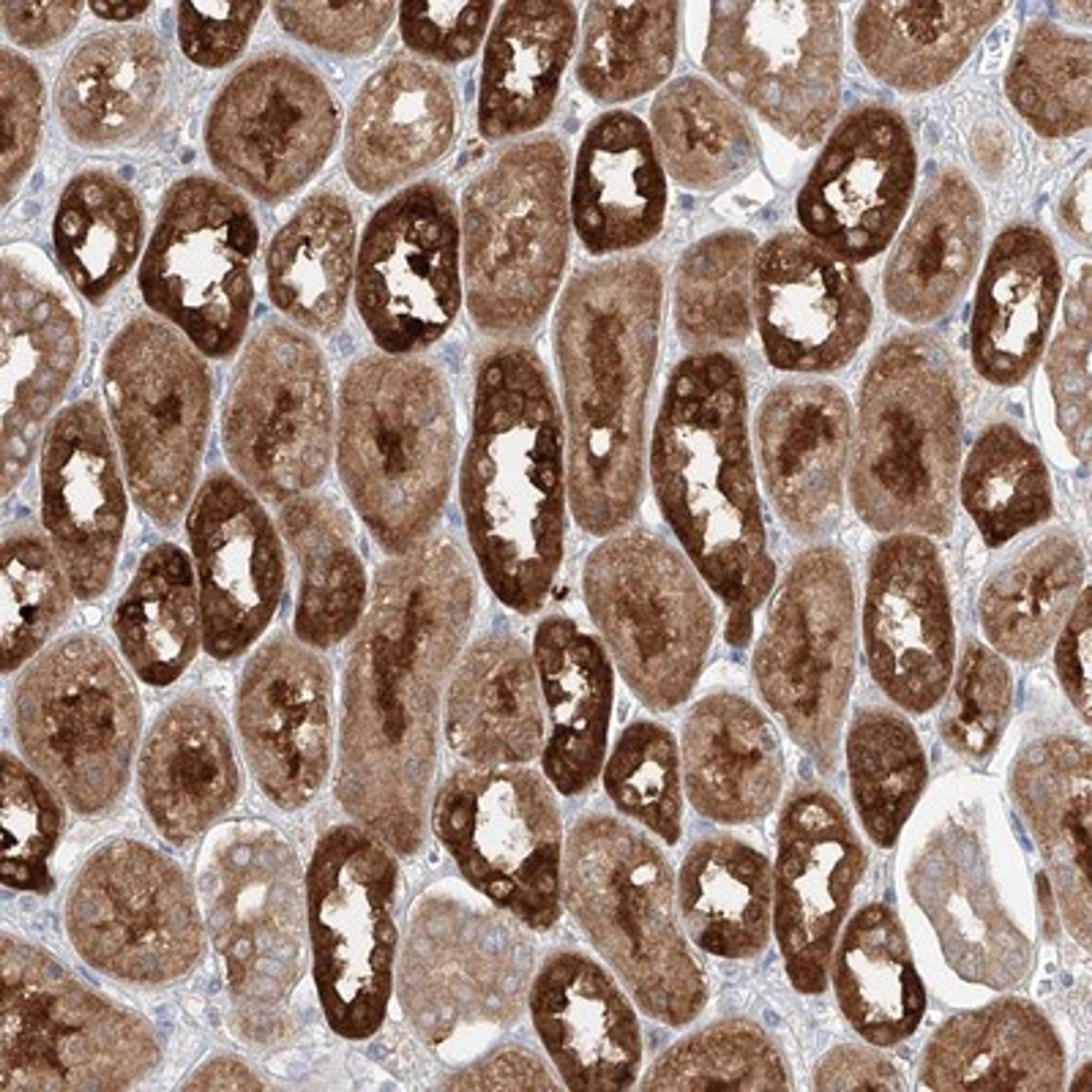 Immunohistochemistry-Paraffin: EGR4 Antibody [NBP1-80999] - Staining of human kidney shows strong cytoplasmic positivity in tubular cells.