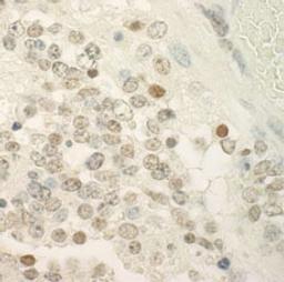 Detection of mouse PRCC by immunohistochemistry.