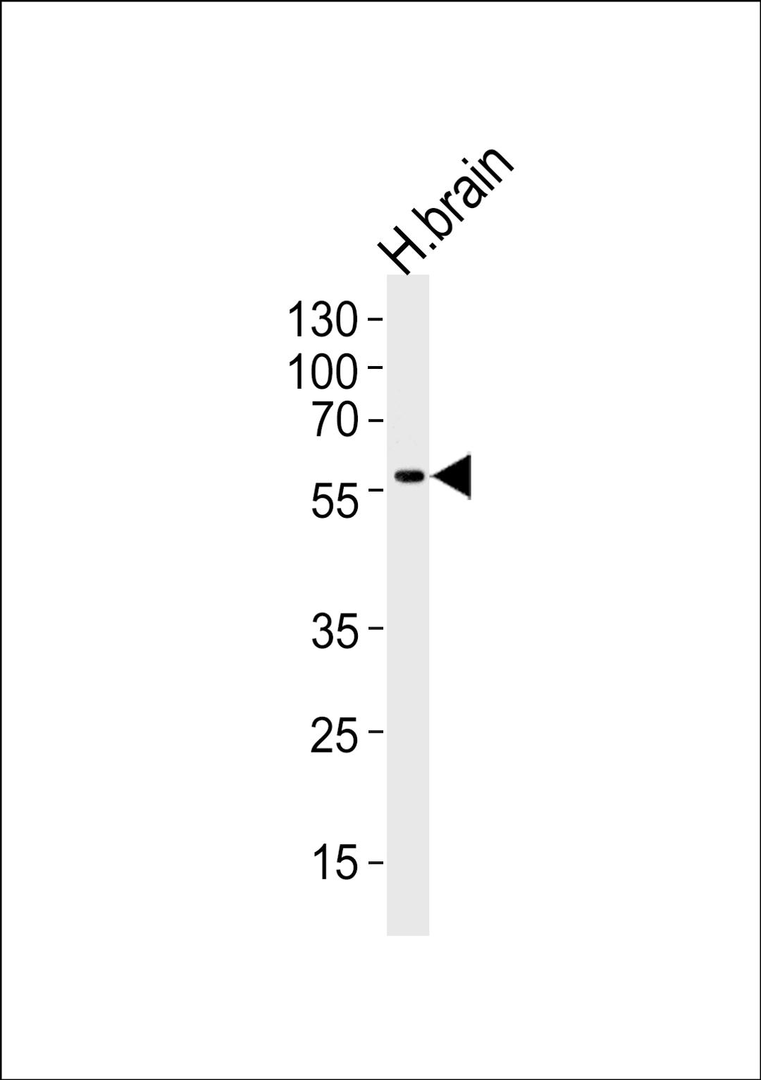 Western blot analysis of lysate from human brain tissue lysate, using Phospho-DCX-S128. ctrl at 1:1000 at each lane.