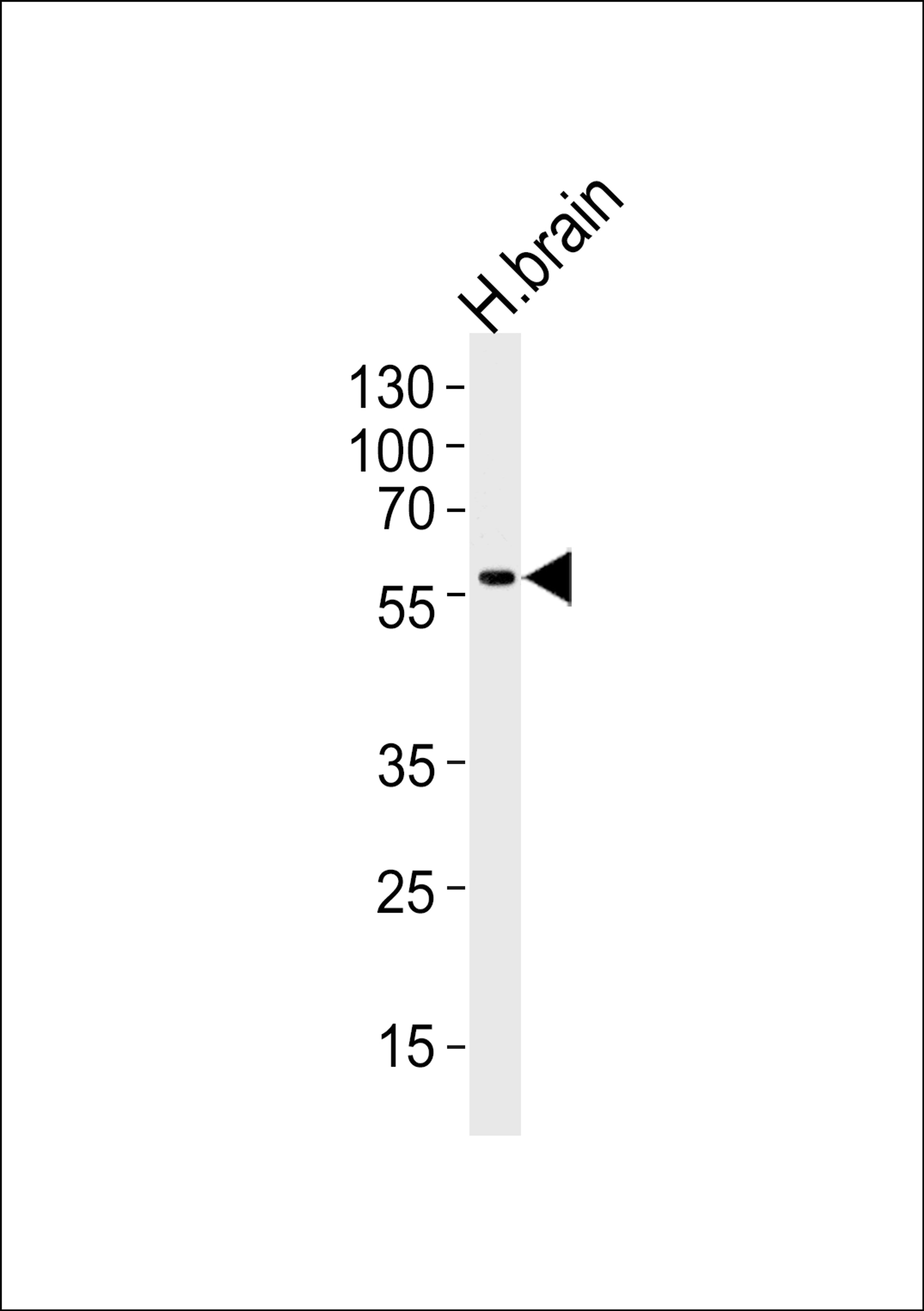 Western blot analysis of lysate from human brain tissue lysate, using Phospho-DCX-S128. ctrl at 1:1000 at each lane.