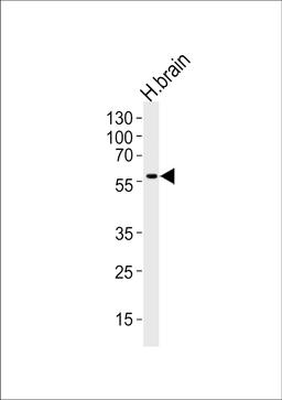 Western blot analysis of lysate from human brain tissue lysate, using Phospho-DCX-S128. ctrl at 1:1000 at each lane.