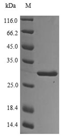 (Tris-Glycine gel) Discontinuous SDS-PAGE (reduced) with 5% enrichment gel and 15% separation gel.
