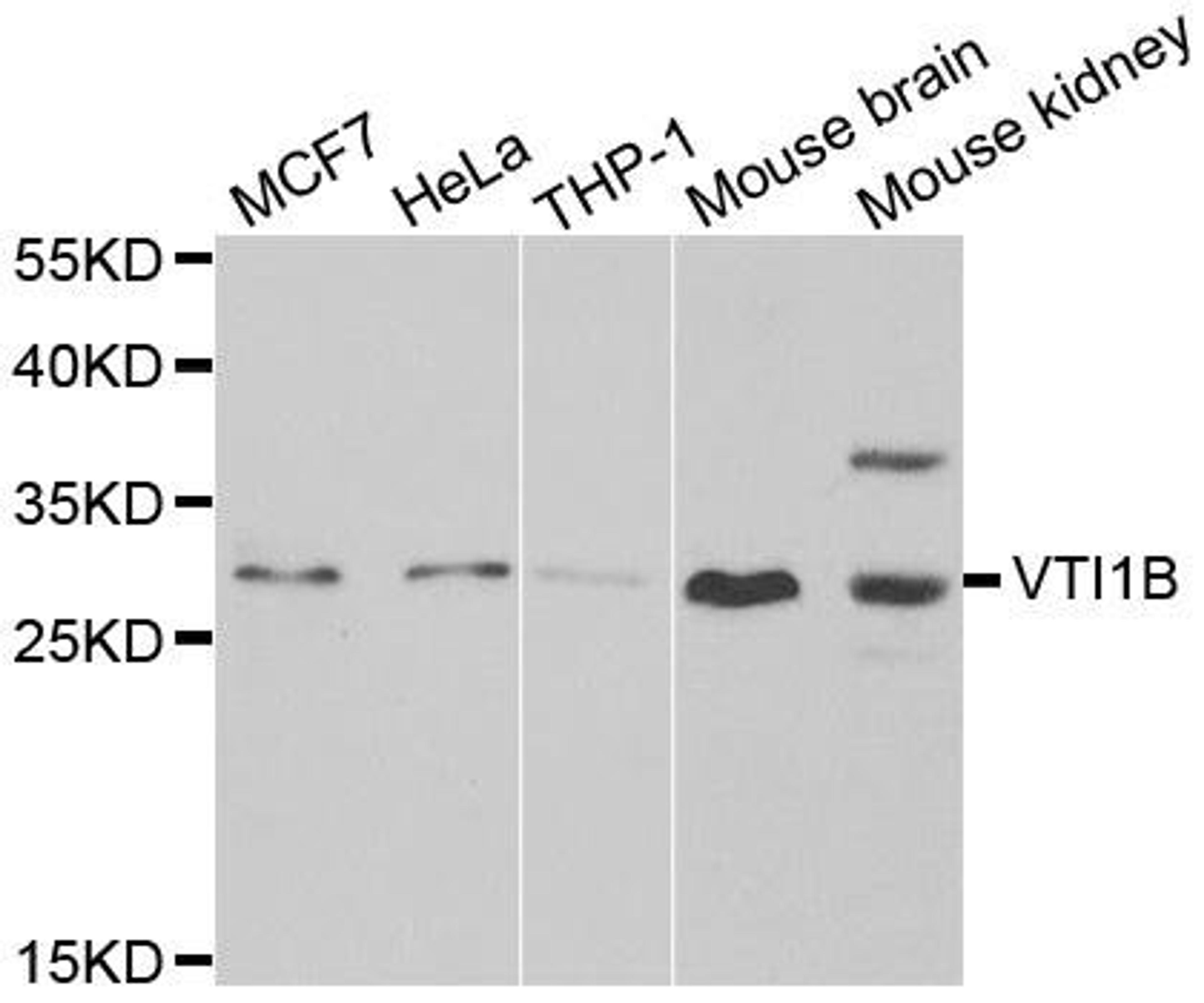 Western blot analysis of extracts of various cell lines using VTI1B antibody