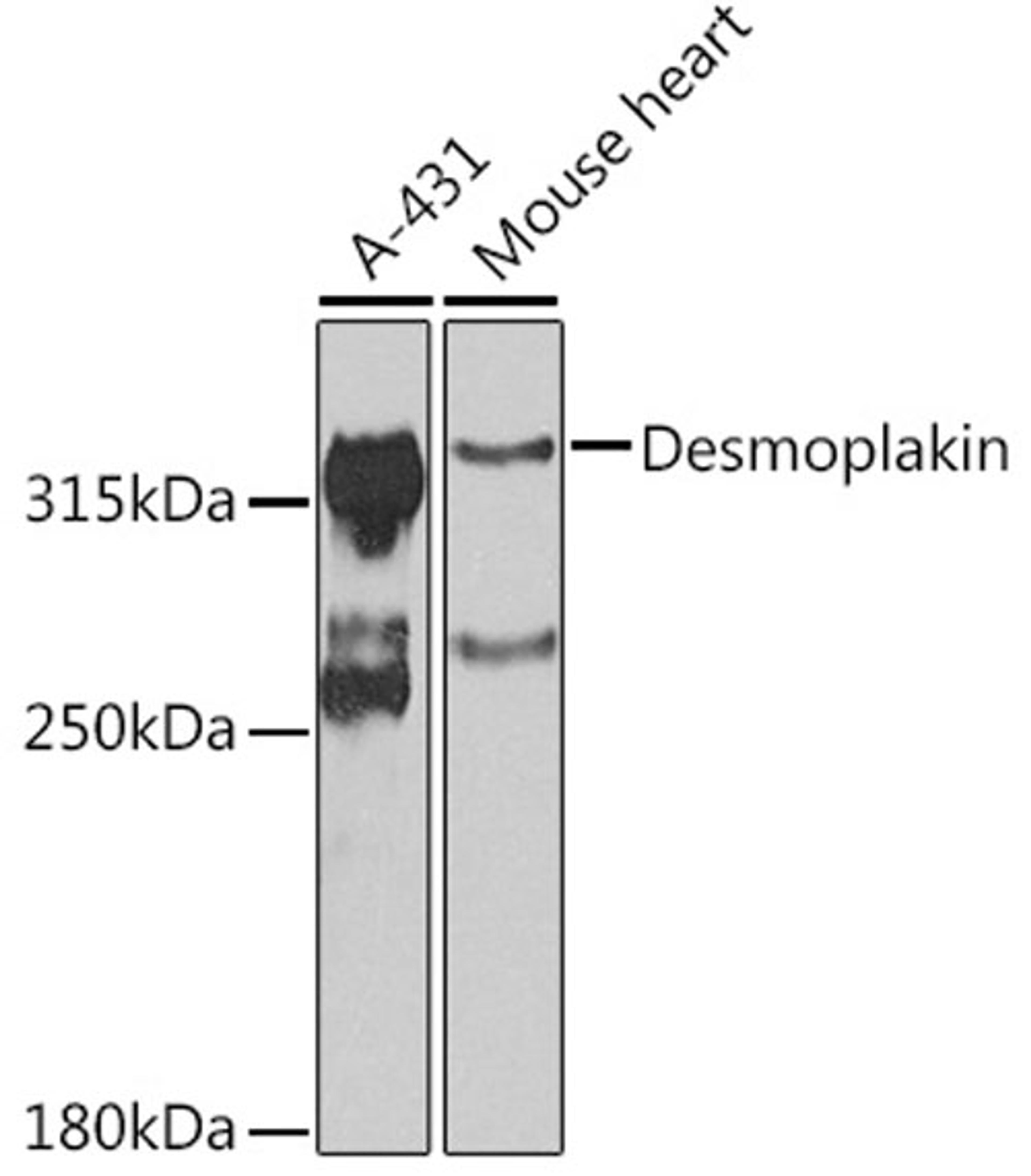 Western blot - Desmoplakin antibody (A7635)