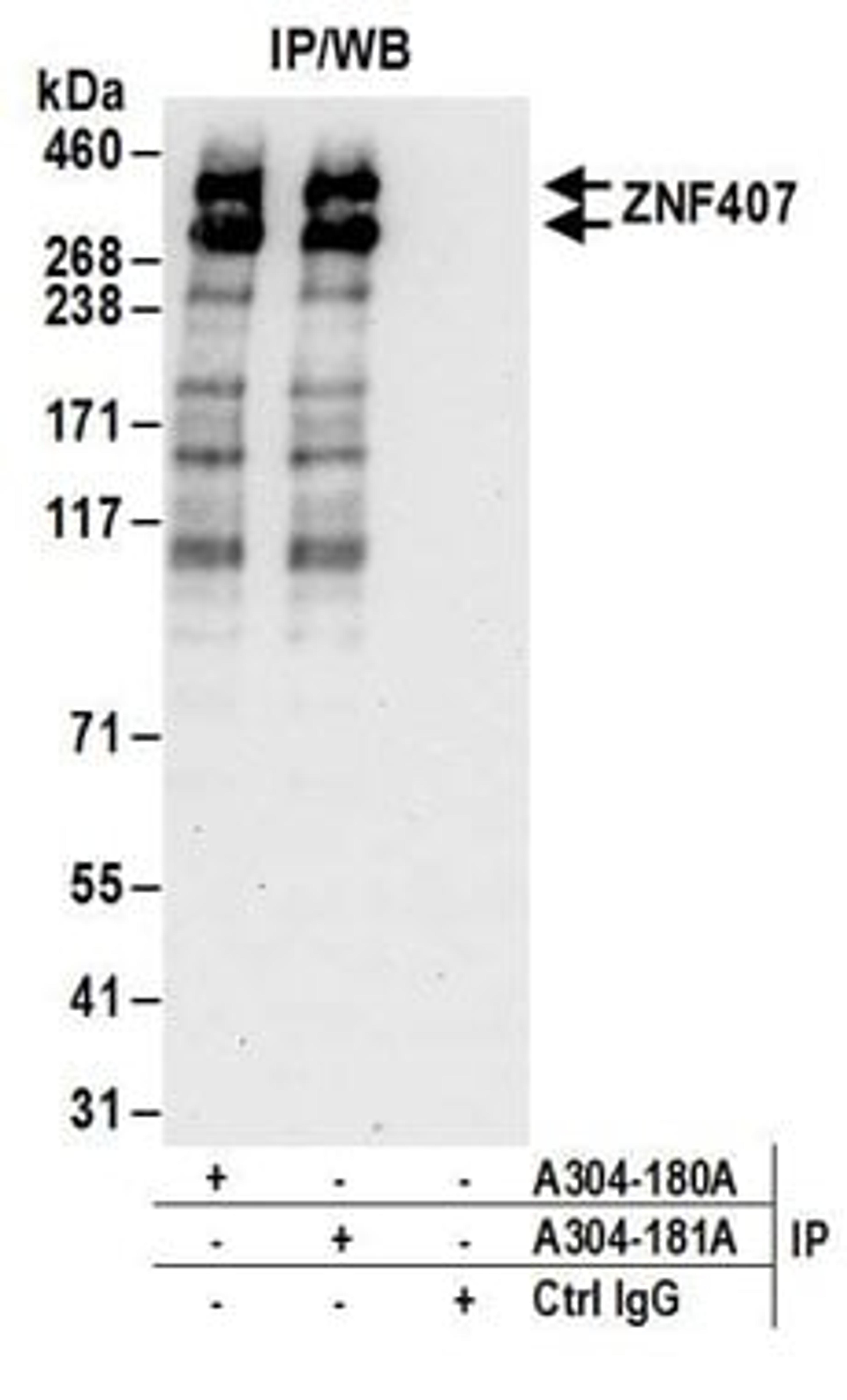 Detection of human ZNF407 by western blot of immunoprecipitates.