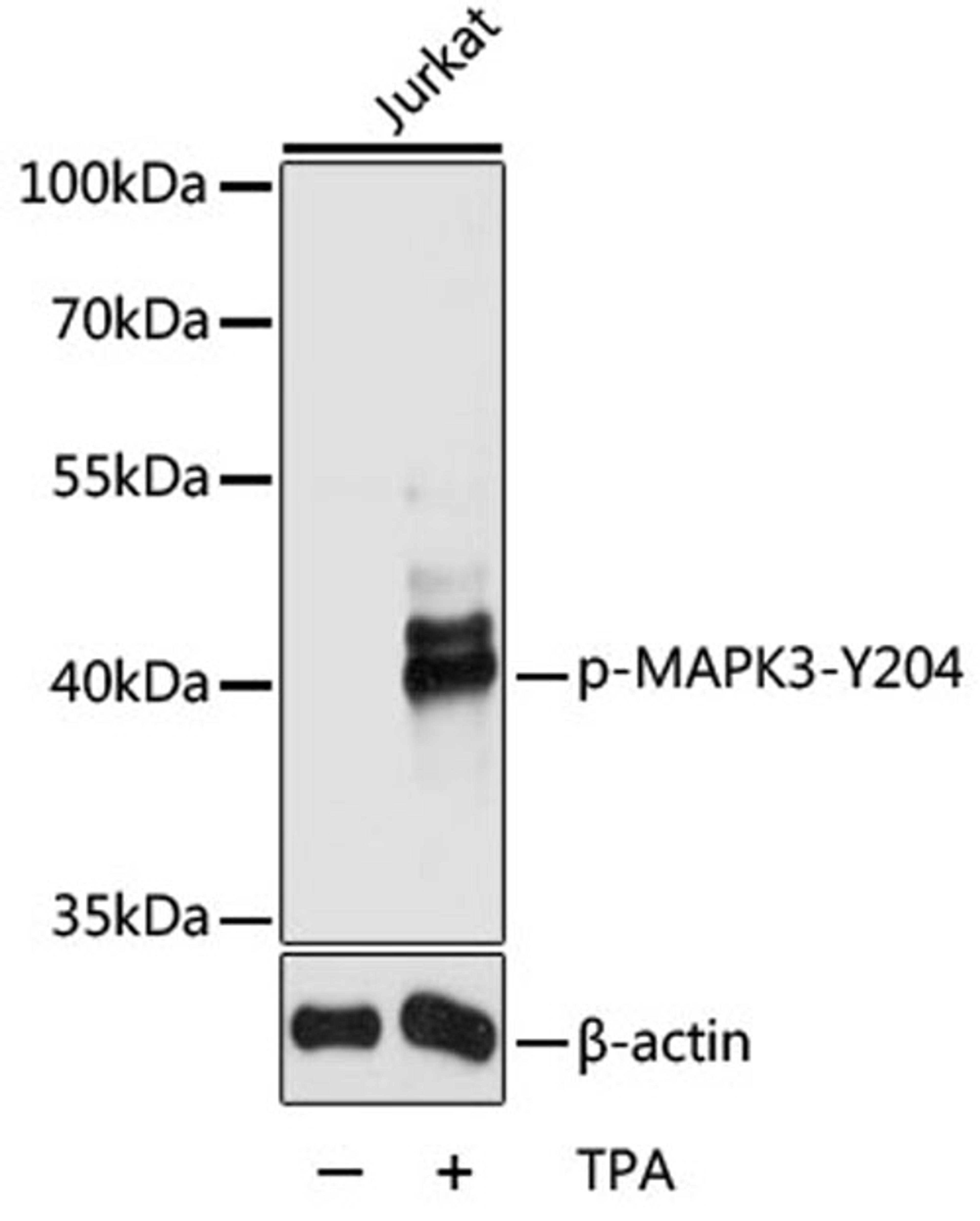 Western blot - Phospho-MAPK3-Y204 antibody (AP0235)