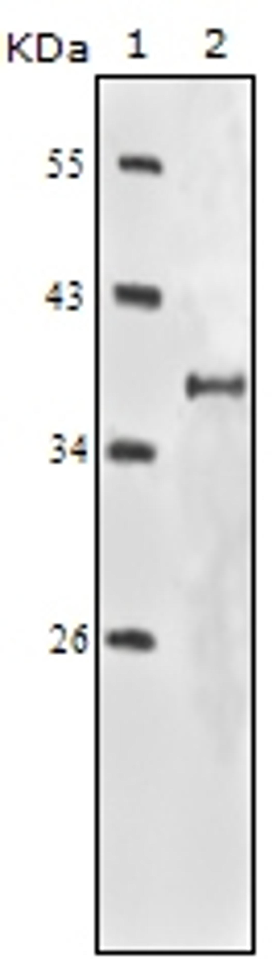 Western blot analysis using IGF1R monoclonal antibody against truncated IGF1R - His recombinant protein