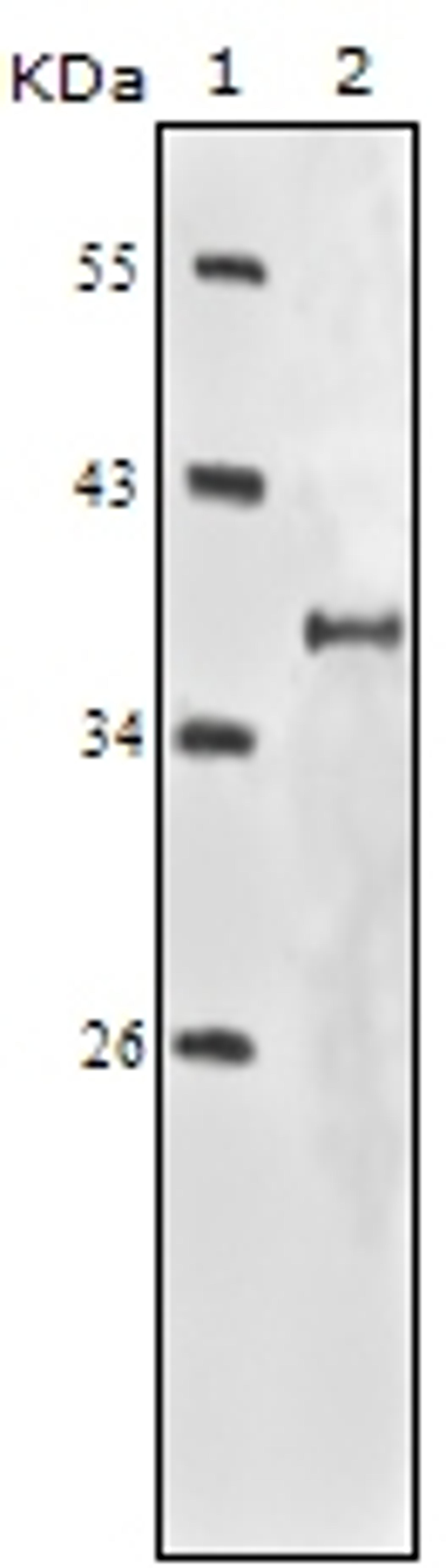 Western blot analysis using IGF1R monoclonal antibody against truncated IGF1R - His recombinant protein