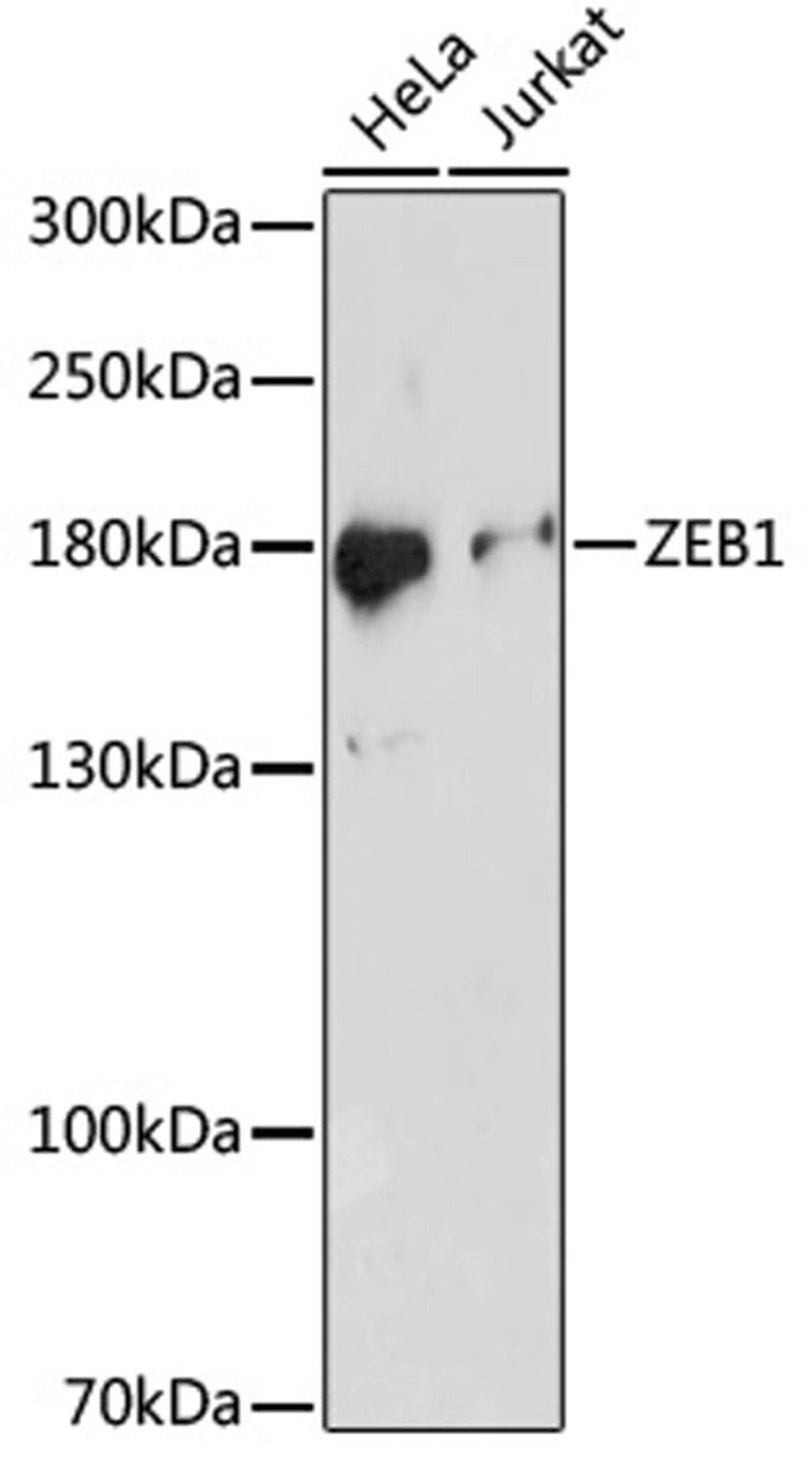 Western blot - ZEB1 antibody (A16981)