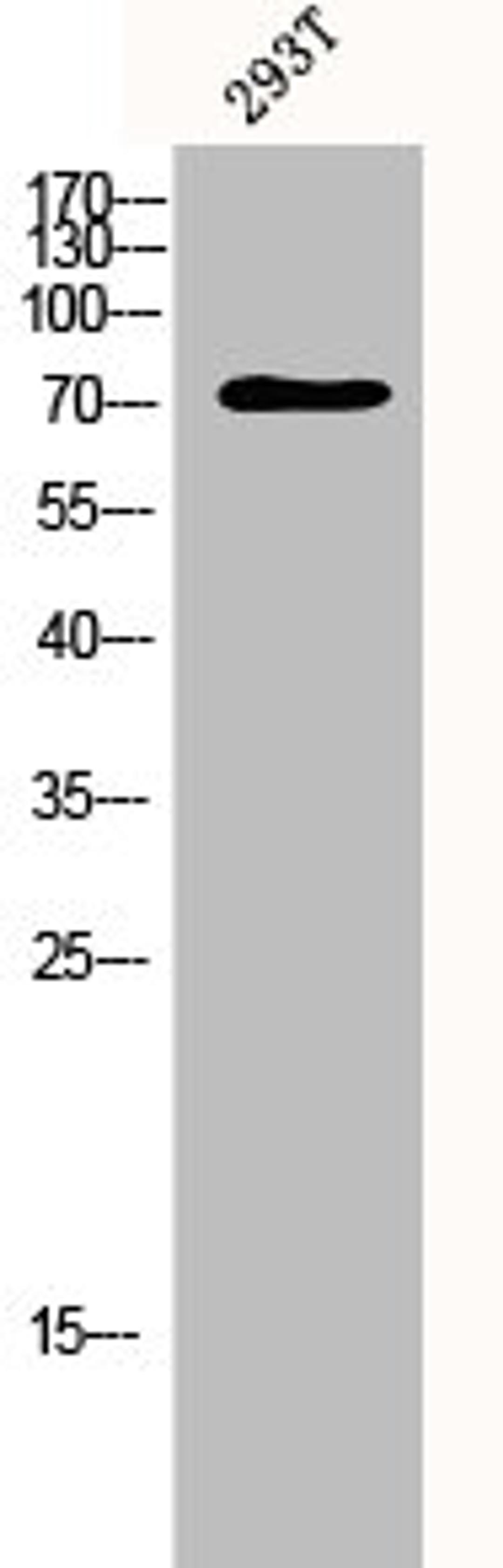 Western Blot analysis of 293T cells using p73 Polyclonal Antibody