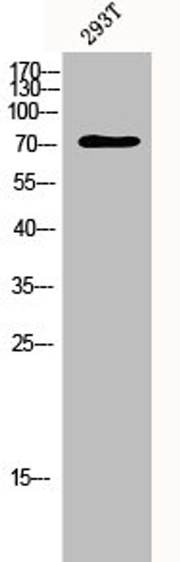 Western Blot analysis of 293T cells using p73 Polyclonal Antibody