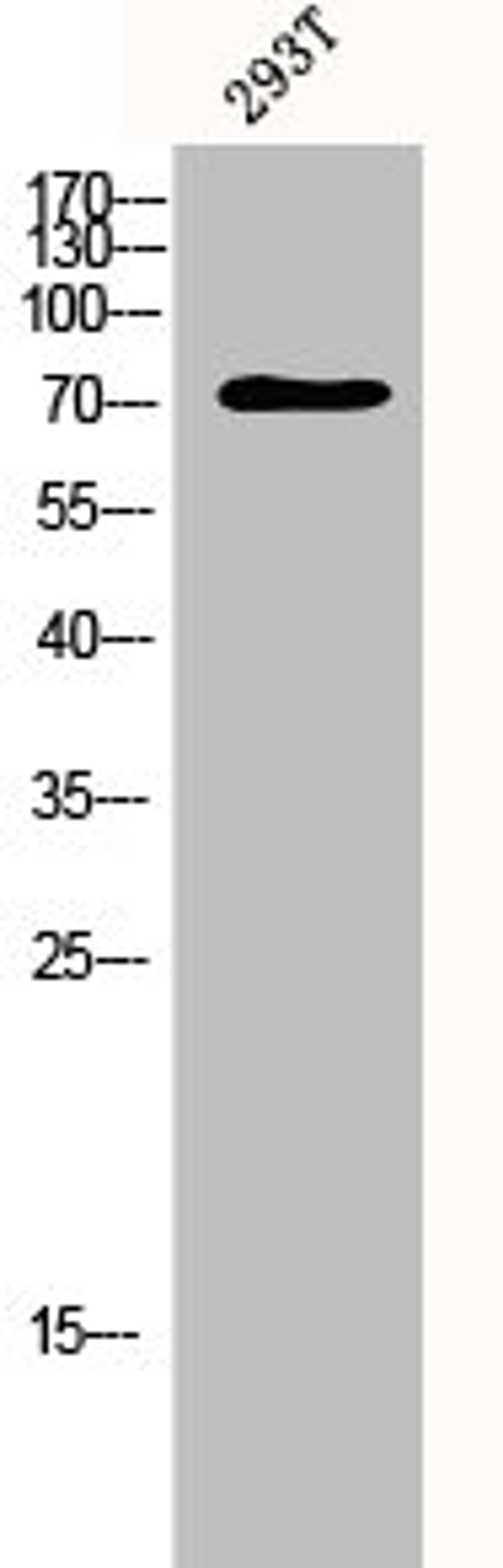Western Blot analysis of 293T cells using p73 Polyclonal Antibody