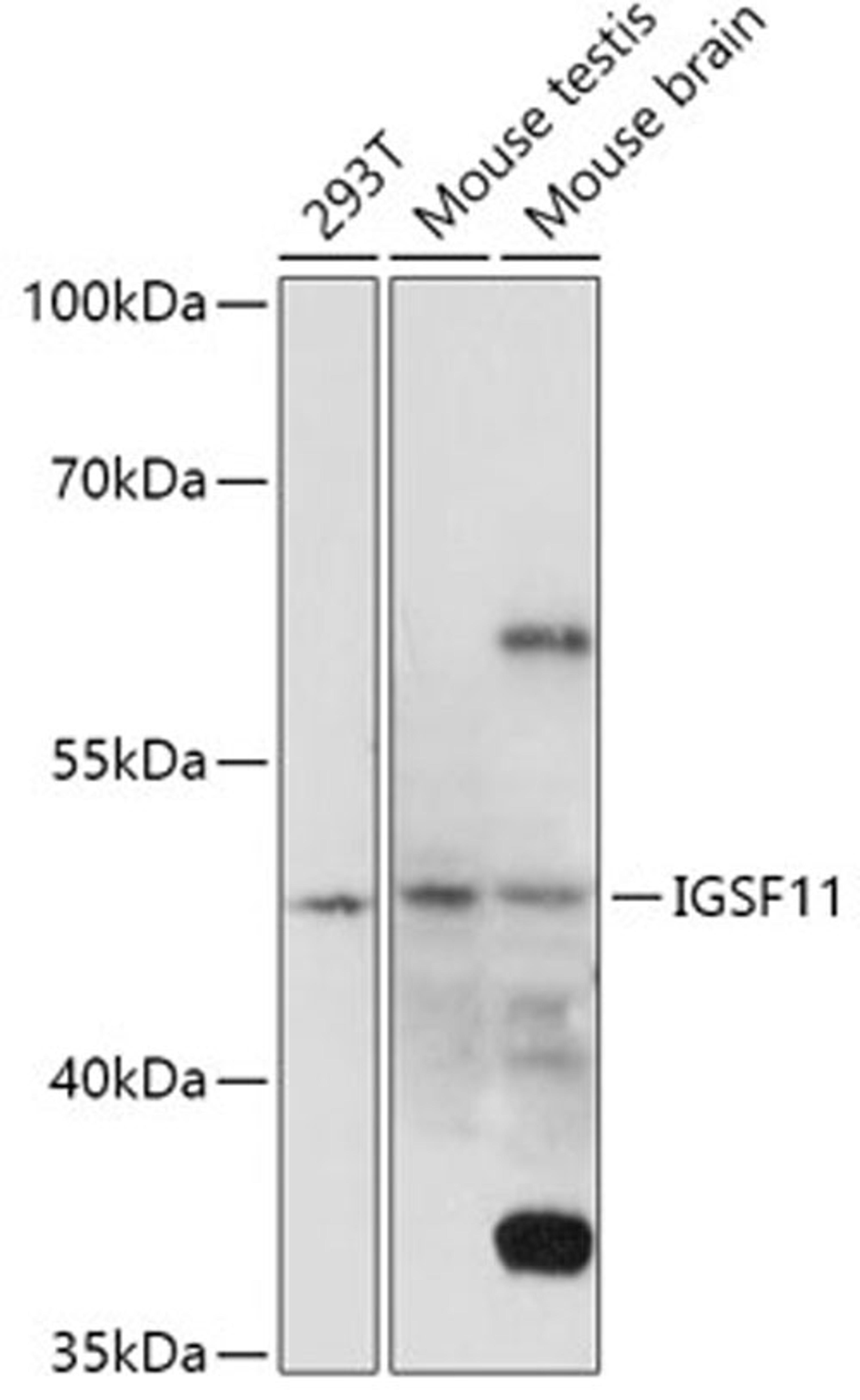 Western blot - IGSF11 antibody (A17837)