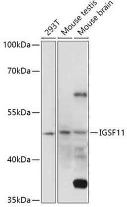 Western blot - IGSF11 antibody (A17837)