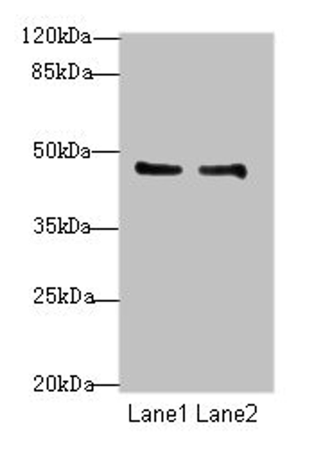 Western blot. All lanes: GPR34 antibody at 8ug/ml. Lane 1: Mouse liver tissue. Lane 2: Mouse kidney tissue. Secondary. Goat polyclonal to rabbit IgG at 1/10000 dilution. Predicted band size: 44 kDa. Observed band size: 44 kDa.