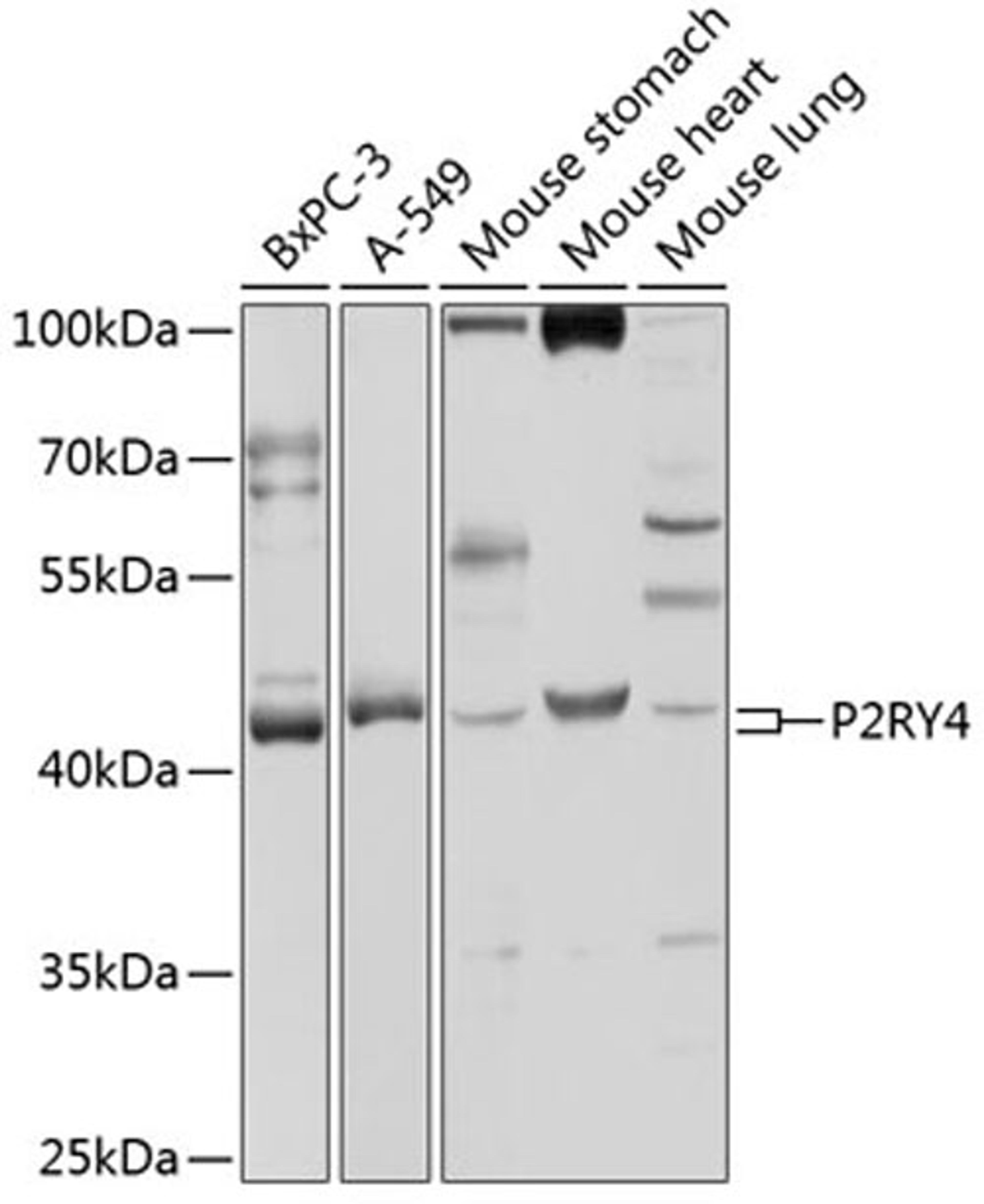 Western blot - P2RY4 antibody (A3059)