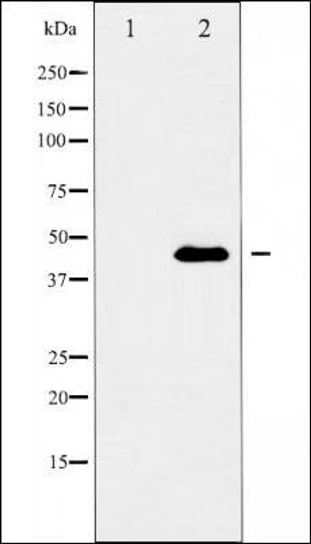 Western blot analysis of NIH/3T3 cells using GATA 5 antibody