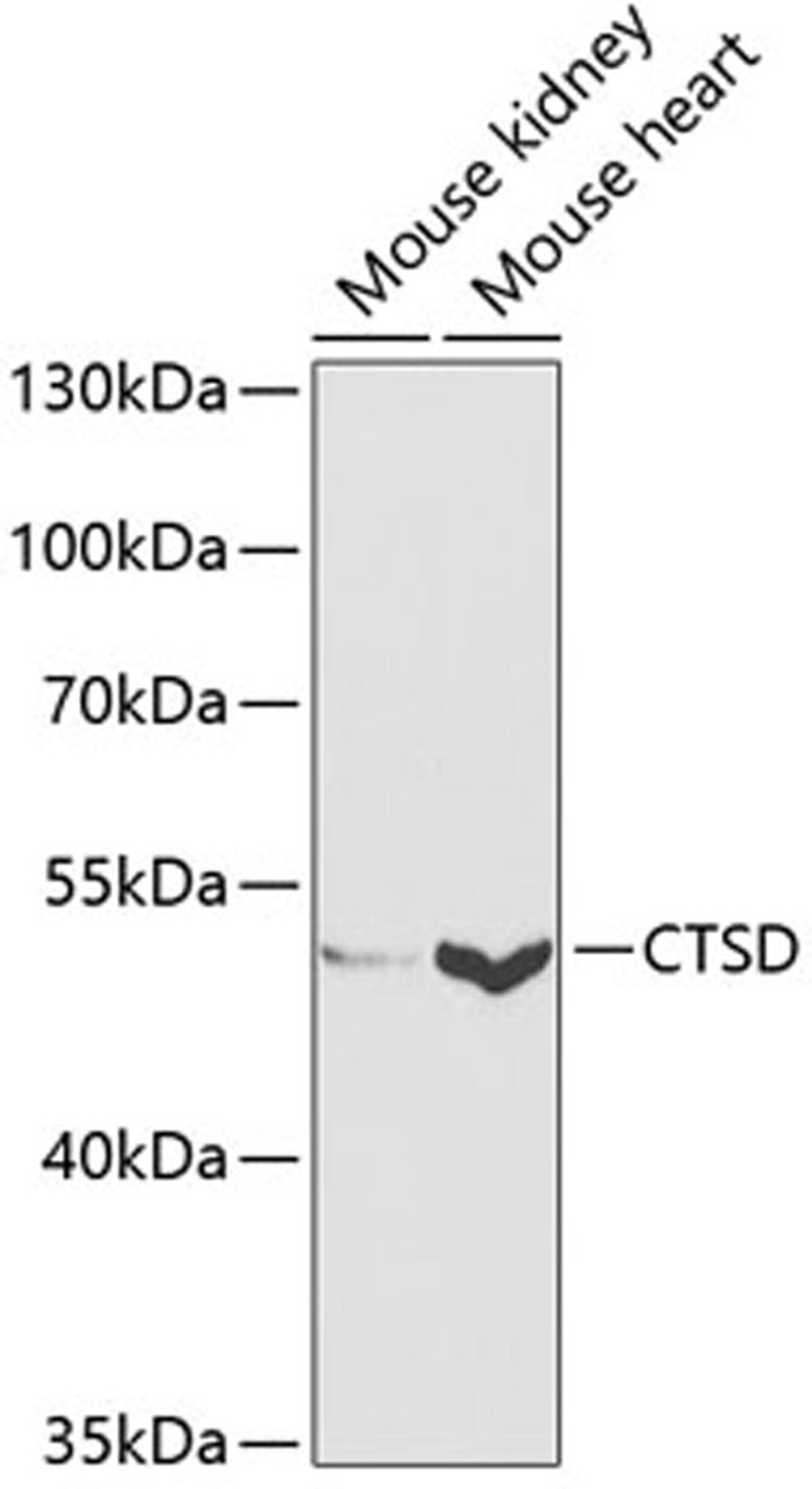 Western blot - CTSD antibody (A13292)