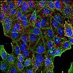 Immunofluorescence analysis of human HeLa cell line lysate using Clathrin (H chain) antibody