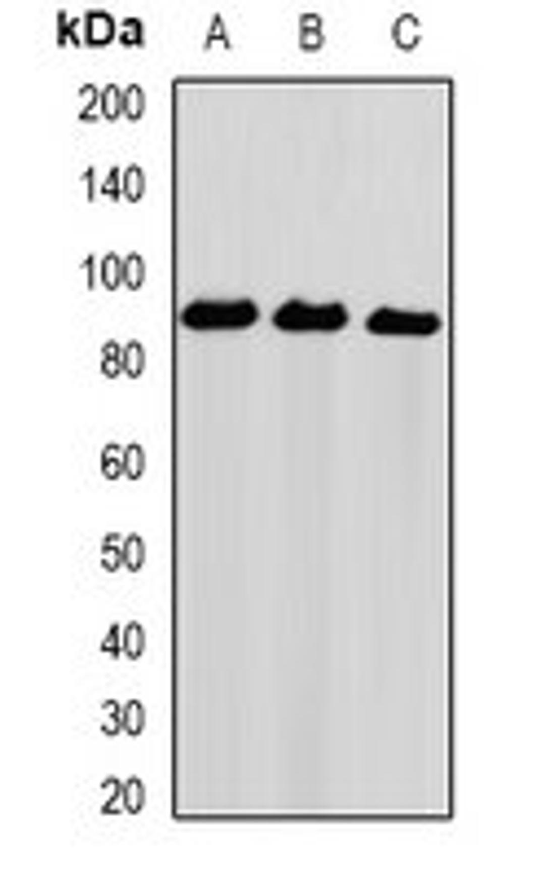 Western blot analysis of Hela (Lane1), PC3 (Lane2), THP1 (Lane3) whole cell lysates using UHRF2 antibody