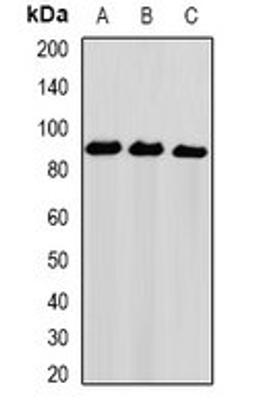 Western blot analysis of Hela (Lane1), PC3 (Lane2), THP1 (Lane3) whole cell lysates using UHRF2 antibody