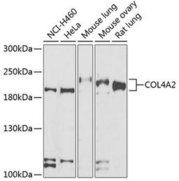 Western blot - COL4A2 antibody (A7657)