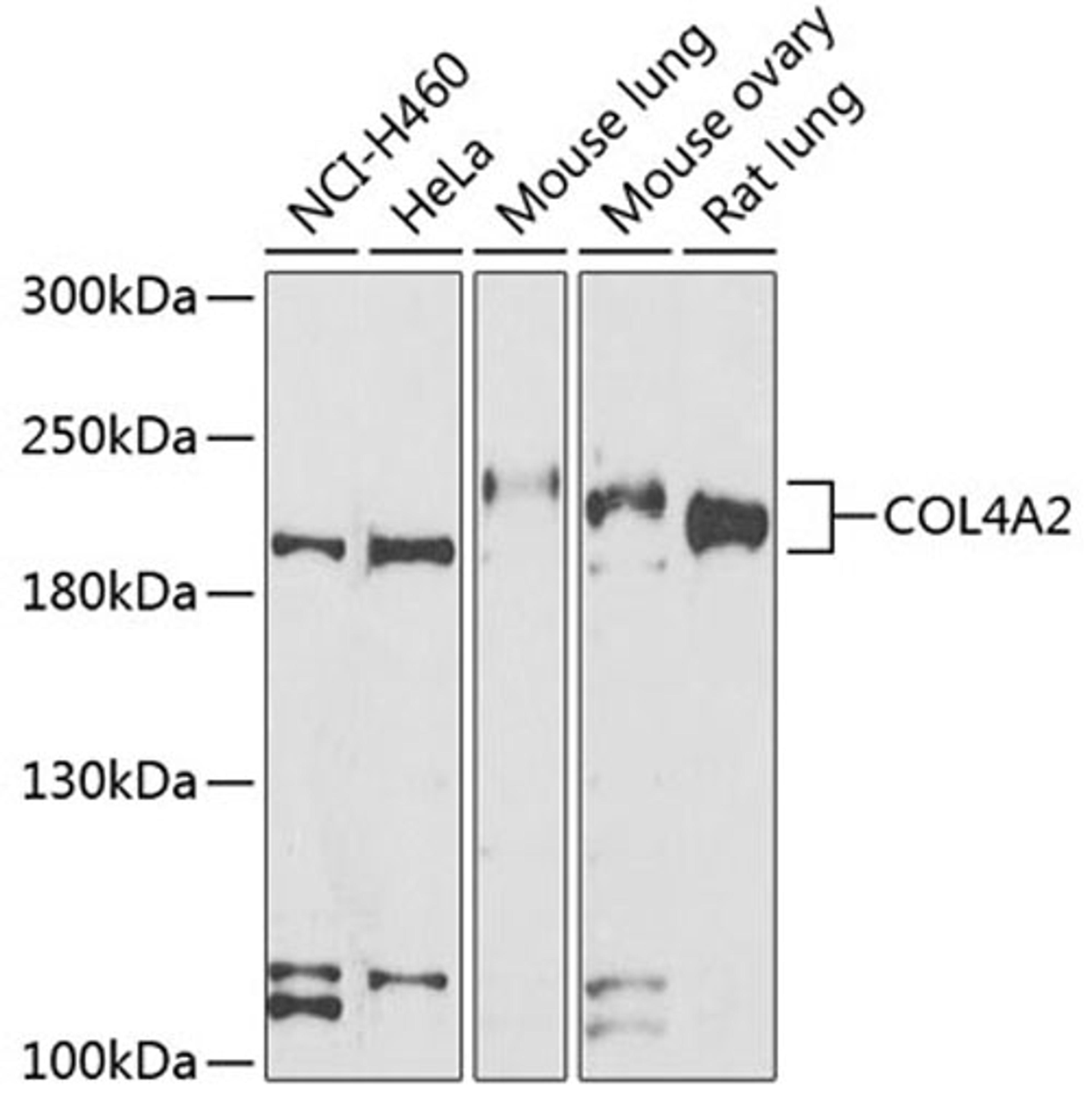 Western blot - COL4A2 antibody (A7657)