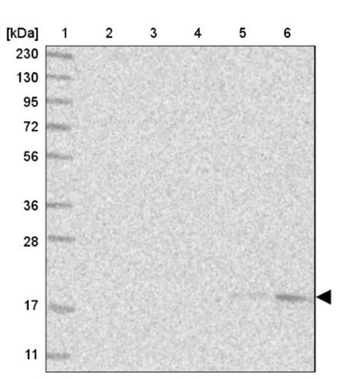 Western Blot: SEC11C Antibody [NBP1-80774] - Lane 1: Marker [kDa] 230, 130, 95, 72, 56, 36, 28, 17, 11<br/>Lane 2: Human cell line RT-4<br/>Lane 3: Human cell line U-251MG sp<br/>Lane 4: Human plasma (IgG/HSA depleted)<br/>Lane 5: Human liver tissue<br/>Lane 6: Human tonsil tissue