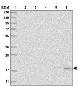 Western Blot: SEC11C Antibody [NBP1-80774] - Lane 1: Marker [kDa] 230, 130, 95, 72, 56, 36, 28, 17, 11<br/>Lane 2: Human cell line RT-4<br/>Lane 3: Human cell line U-251MG sp<br/>Lane 4: Human plasma (IgG/HSA depleted)<br/>Lane 5: Human liver tissue<br/>Lane 6: Human tonsil tissue