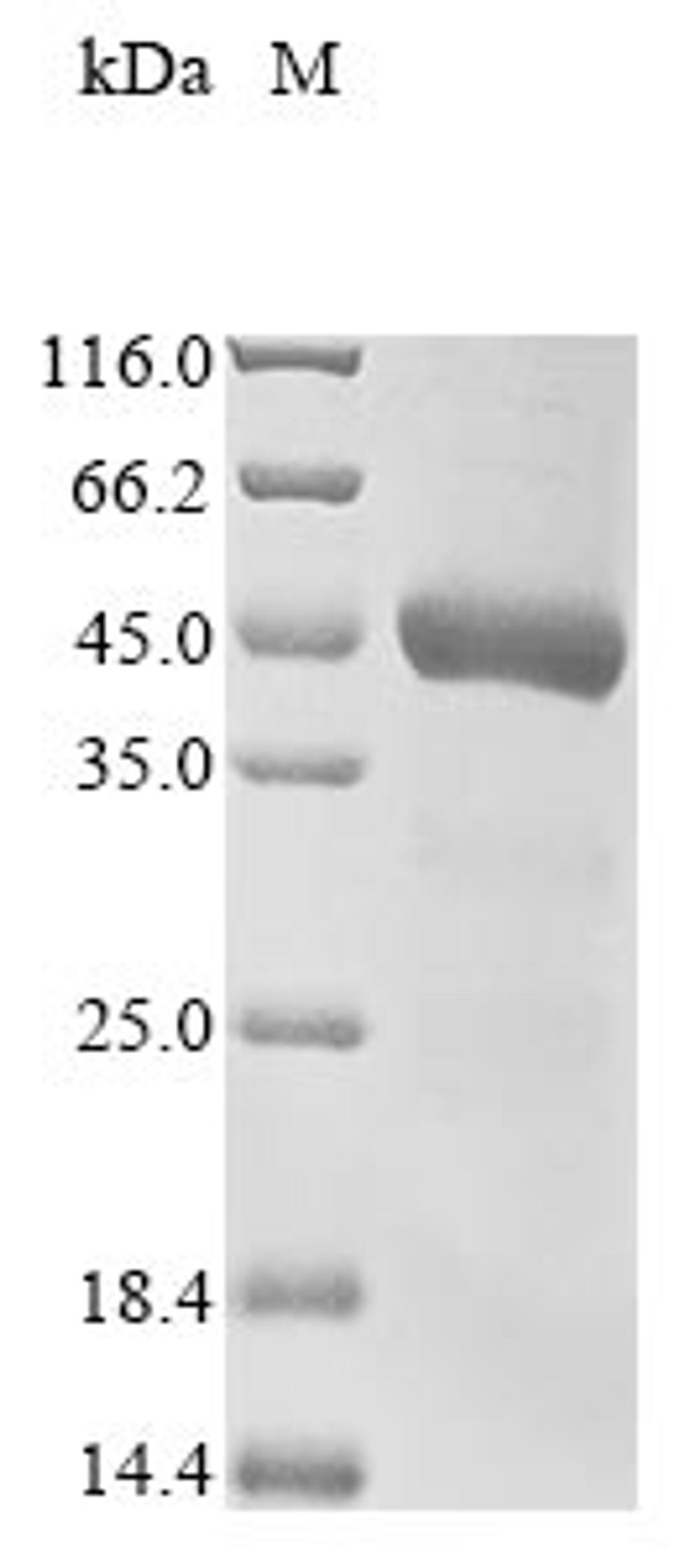 (Tris-Glycine gel) Discontinuous SDS-PAGE (reduced) with 5% enrichment gel and 15% separation gel.