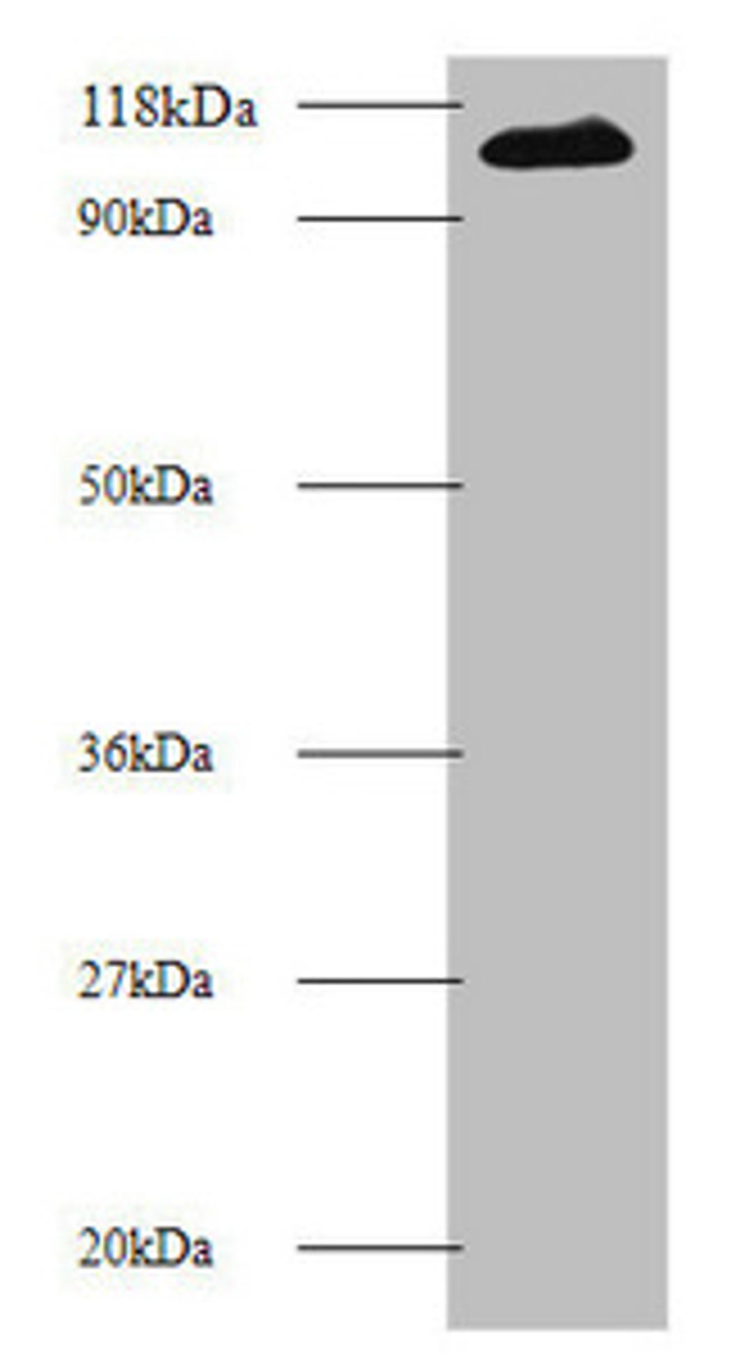 Western blot. All lanes: MIB1 antibody at 2µg/ml + 293T whole cell lysate. Secondary. Goat polyclonal to rabbit IgG at 1/10000 dilution. Predicted band size: 111 kDa. Observed band size: 111 kDa