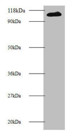 Western blot. All lanes: MIB1 antibody at 2µg/ml + 293T whole cell lysate. Secondary. Goat polyclonal to rabbit IgG at 1/10000 dilution. Predicted band size: 111 kDa. Observed band size: 111 kDa