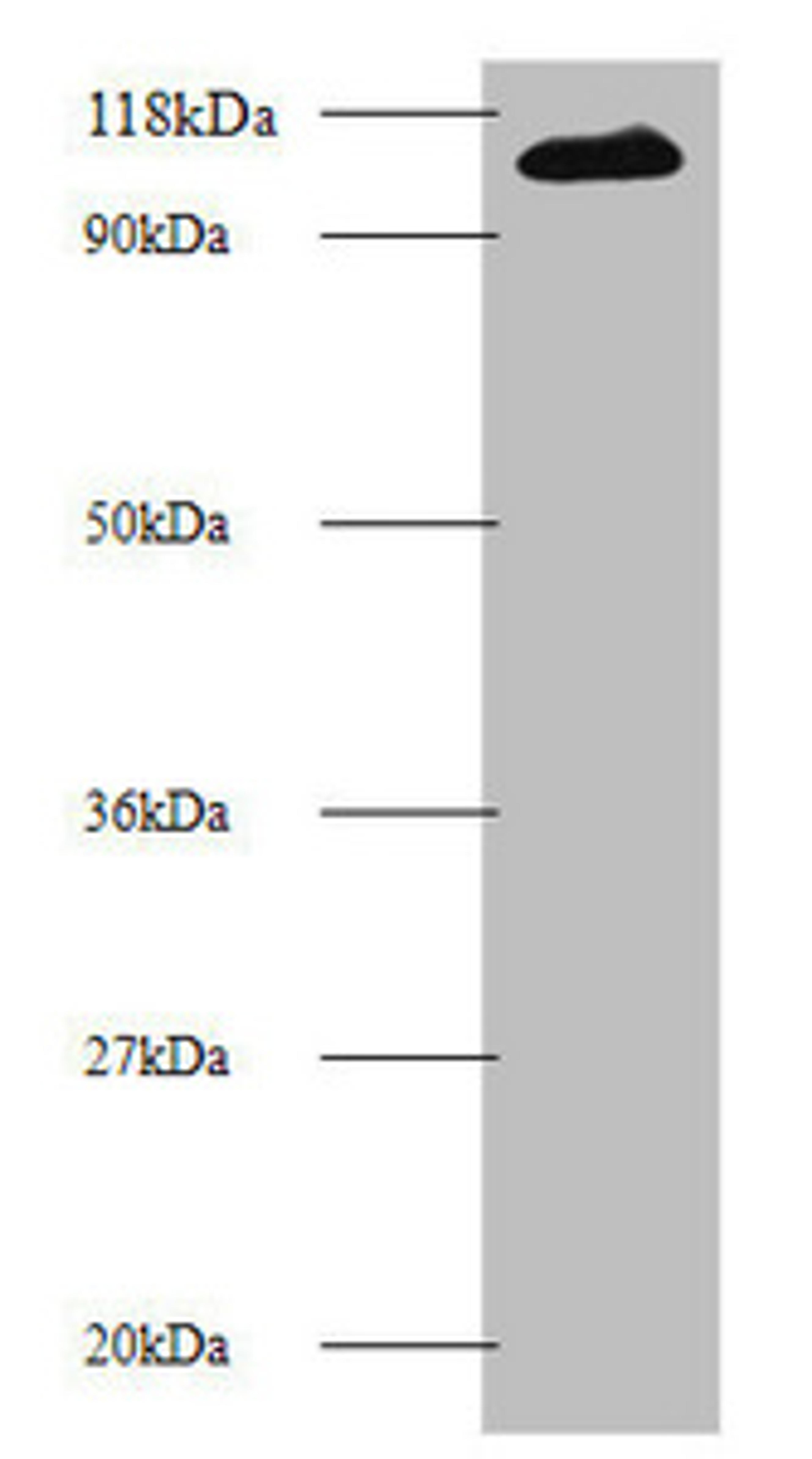 Western blot. All lanes: MIB1 antibody at 2µg/ml + 293T whole cell lysate. Secondary. Goat polyclonal to rabbit IgG at 1/10000 dilution. Predicted band size: 111 kDa. Observed band size: 111 kDa