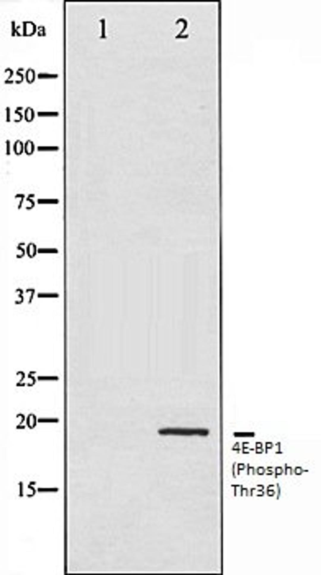 Western blot analysis of MDA-MB-435 whole cell lysates using 4E-BP1 (Phospho-Thr36) antibody, The lane on the left is treated with the antigen-specific peptide.