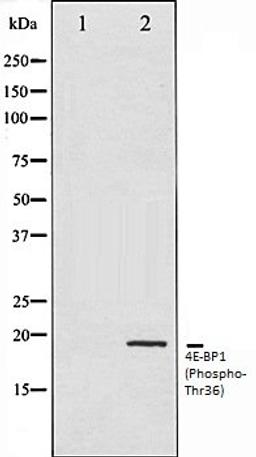 Western blot analysis of MDA-MB-435 whole cell lysates using 4E-BP1 (Phospho-Thr36) antibody, The lane on the left is treated with the antigen-specific peptide.