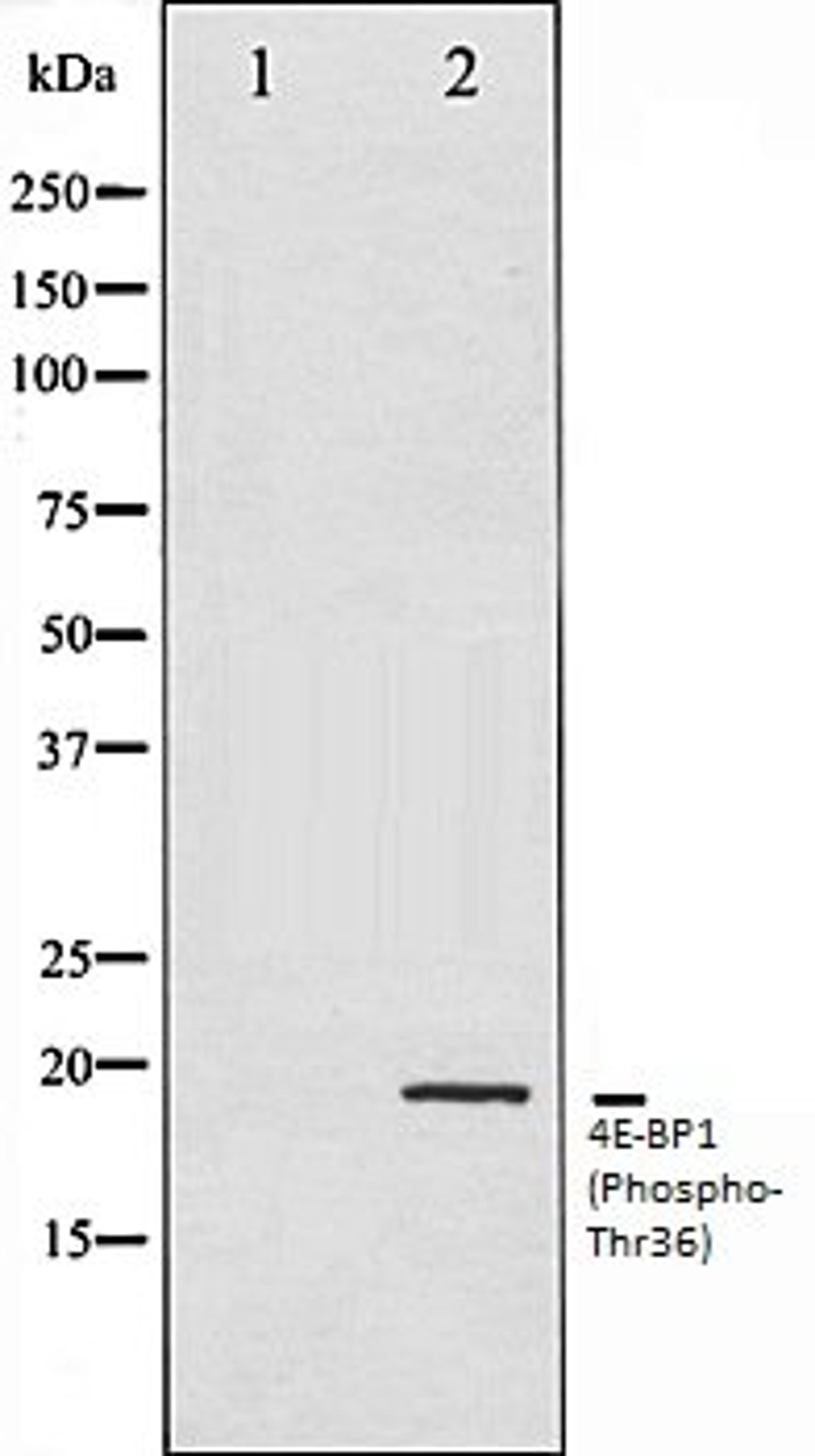 Western blot analysis of MDA-MB-435 whole cell lysates using 4E-BP1 (Phospho-Thr36) antibody, The lane on the left is treated with the antigen-specific peptide.