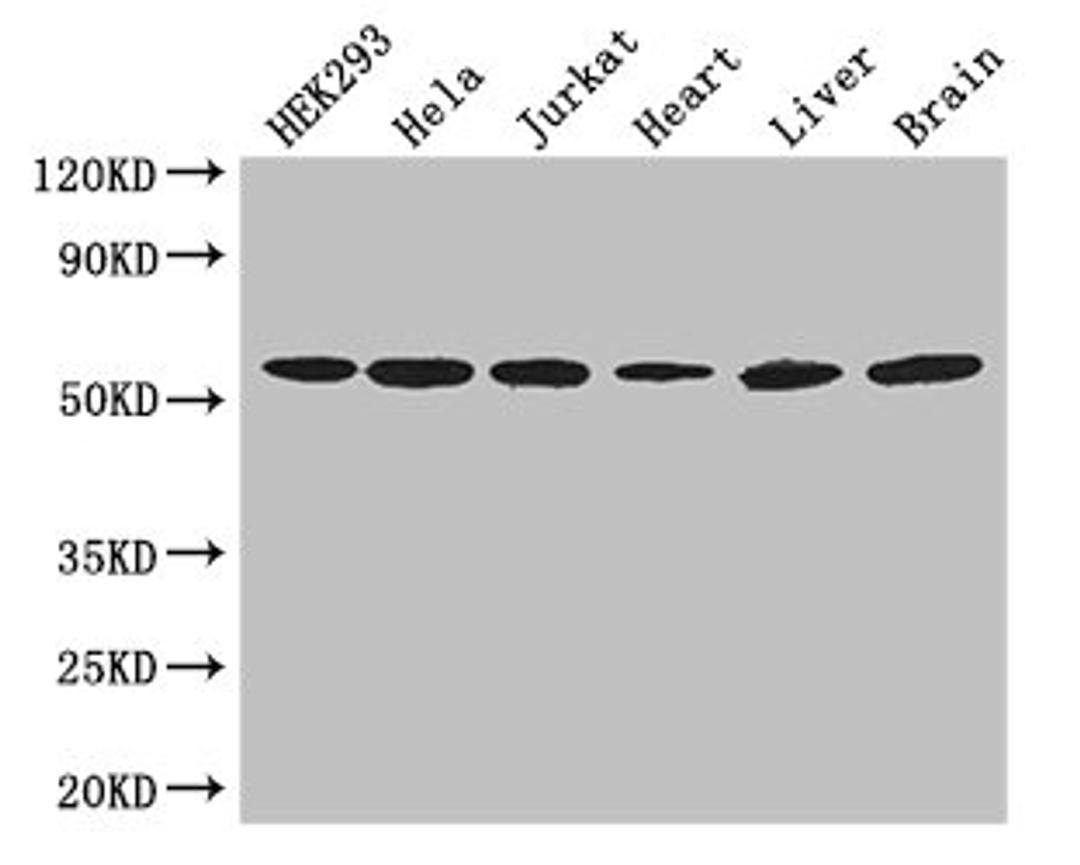 Western Blot. Positive WB detected in: HEK293 whole cell lysate, Hela whole cell lysate, Jurkat whole cell lysate, Mouse heart tissue, Mouse liver tissue, Mouse brain tissue. All lanes: ARIH2 antibody at 3ug/ml. Secondary. Goat polyclonal to rabbit IgG at 1/50000 dilution. Predicted band size: 58 kDa. Observed band size: 58 kDa. 