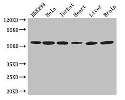 Western Blot. Positive WB detected in: HEK293 whole cell lysate, Hela whole cell lysate, Jurkat whole cell lysate, Mouse heart tissue, Mouse liver tissue, Mouse brain tissue. All lanes: ARIH2 antibody at 3ug/ml. Secondary. Goat polyclonal to rabbit IgG at 1/50000 dilution. Predicted band size: 58 kDa. Observed band size: 58 kDa. 