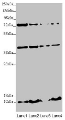 Western blot. All lanes: UQCC2 antibody at 3.35 ug/ml. Lane 1: HepG2 whole cell lysate. Lane 2: 293T whole cell lysate. Lane 3: Jurkat whole cell lysate. Lane 4: A431 whole cell lysate. Secondary. Goat polyclonal to rabbit IgG at 1/10000 dilution. Predicted band size: 15 kDa. Observed band size: 15, 40, 80 kDa. 
