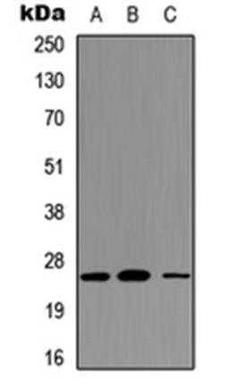 Western blot analysis of HEK293T (Lane 1), NS-1 (Lane 2), PC12 (Lane 3) whole cell lysates using CD354 antibody