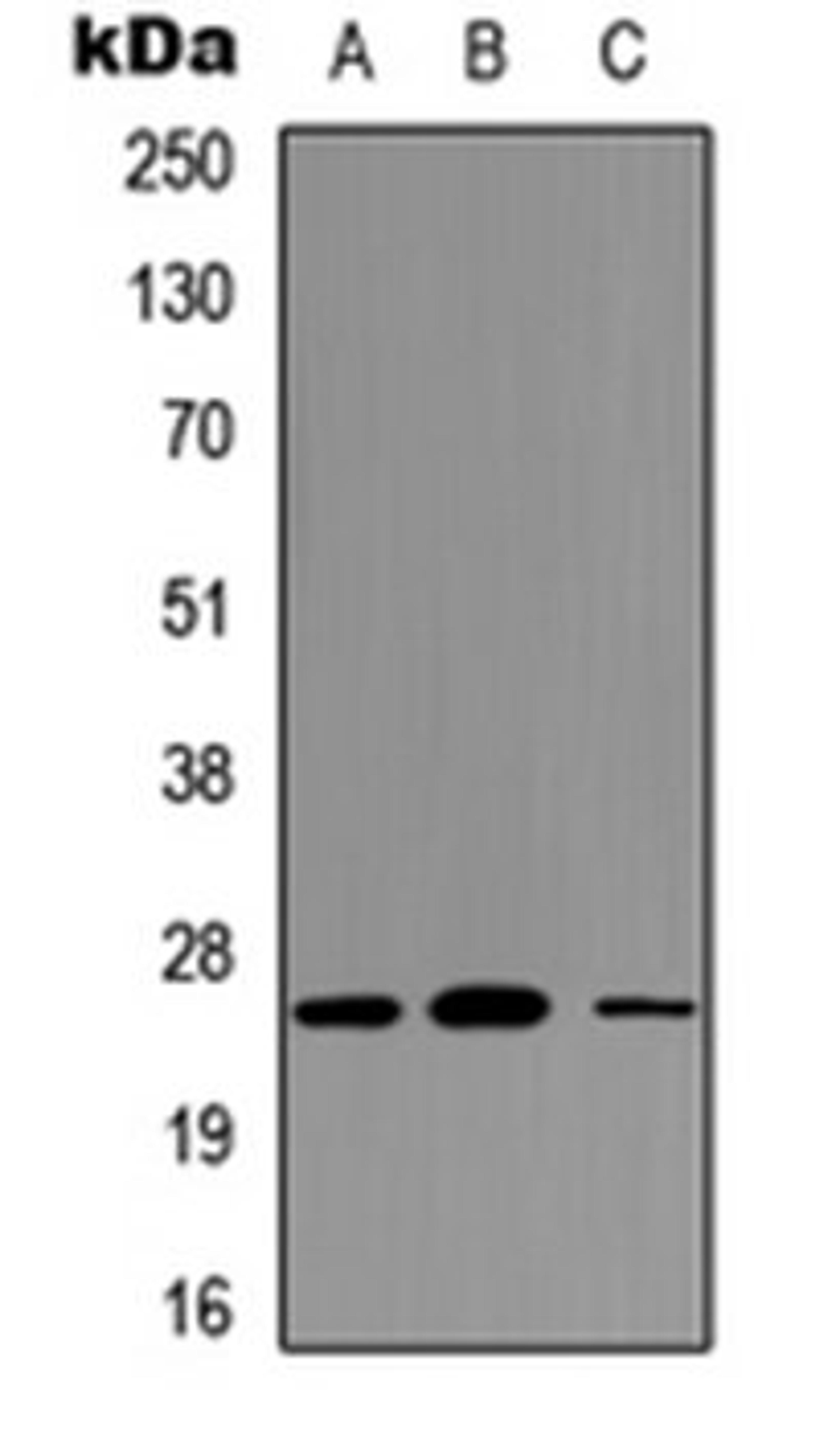 Western blot analysis of HEK293T (Lane 1), NS-1 (Lane 2), PC12 (Lane 3) whole cell lysates using CD354 antibody