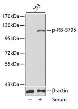 Western blot - phospho-RB-S795 antibody (AP0088)