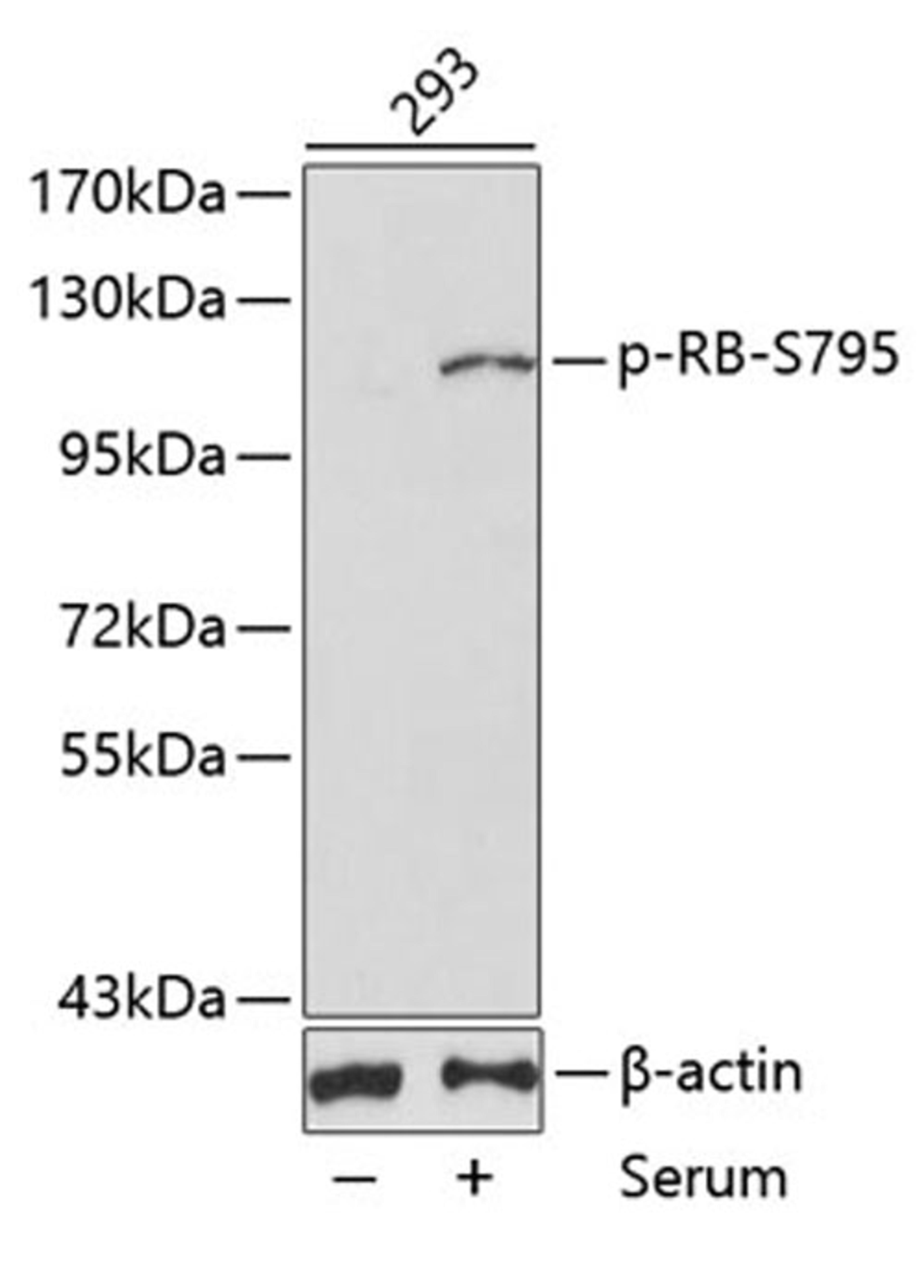 Western blot - phospho-RB-S795 antibody (AP0088)