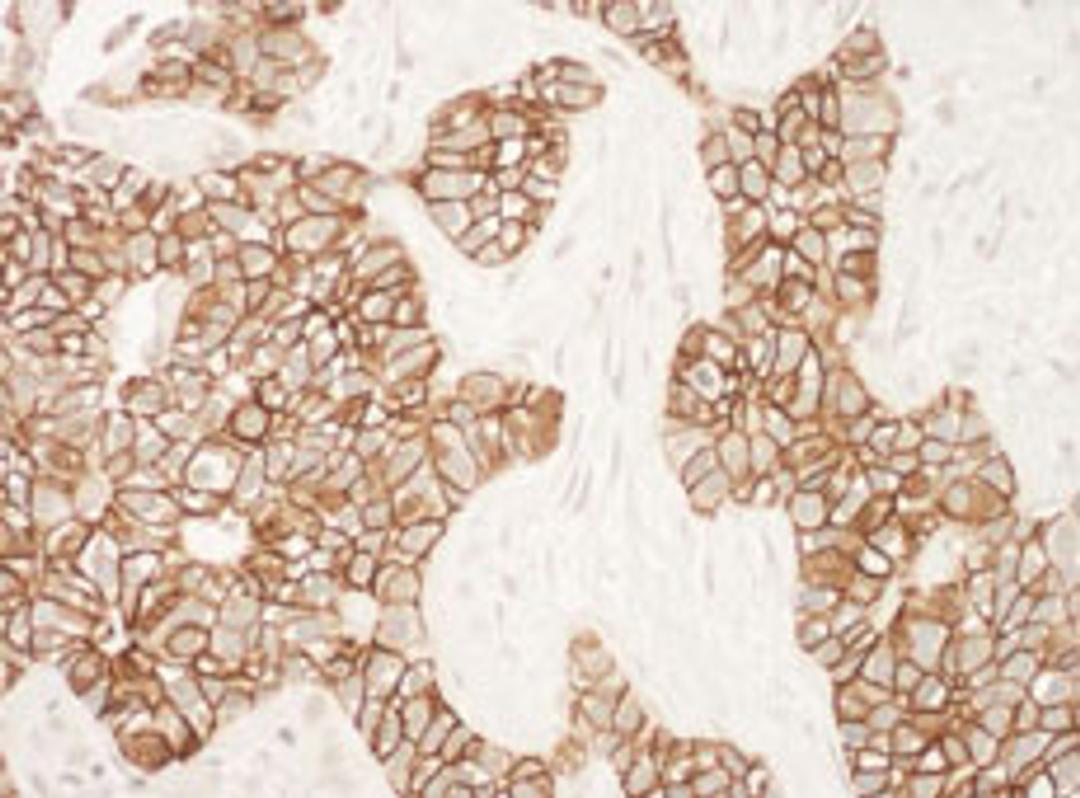 Detection of human ErbB2 by immunohistochemistry.