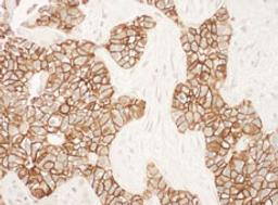 Detection of human ErbB2 by immunohistochemistry.