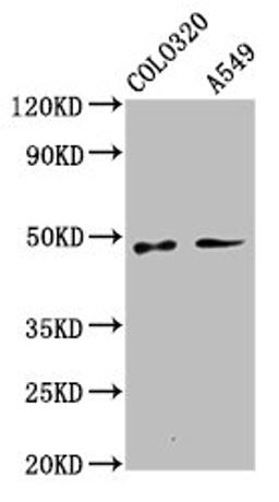 Western Blot. Positive WB detected in: Colo320 whole cell lysate, A549 whole cell lysate. All lanes: PNPLA5 antibody at 3.1µg/ml. Secondary. Goat polyclonal to rabbit IgG at 1/50000 dilution. Predicted band size: 48, 36 kDa. Observed band size: 48 kDa