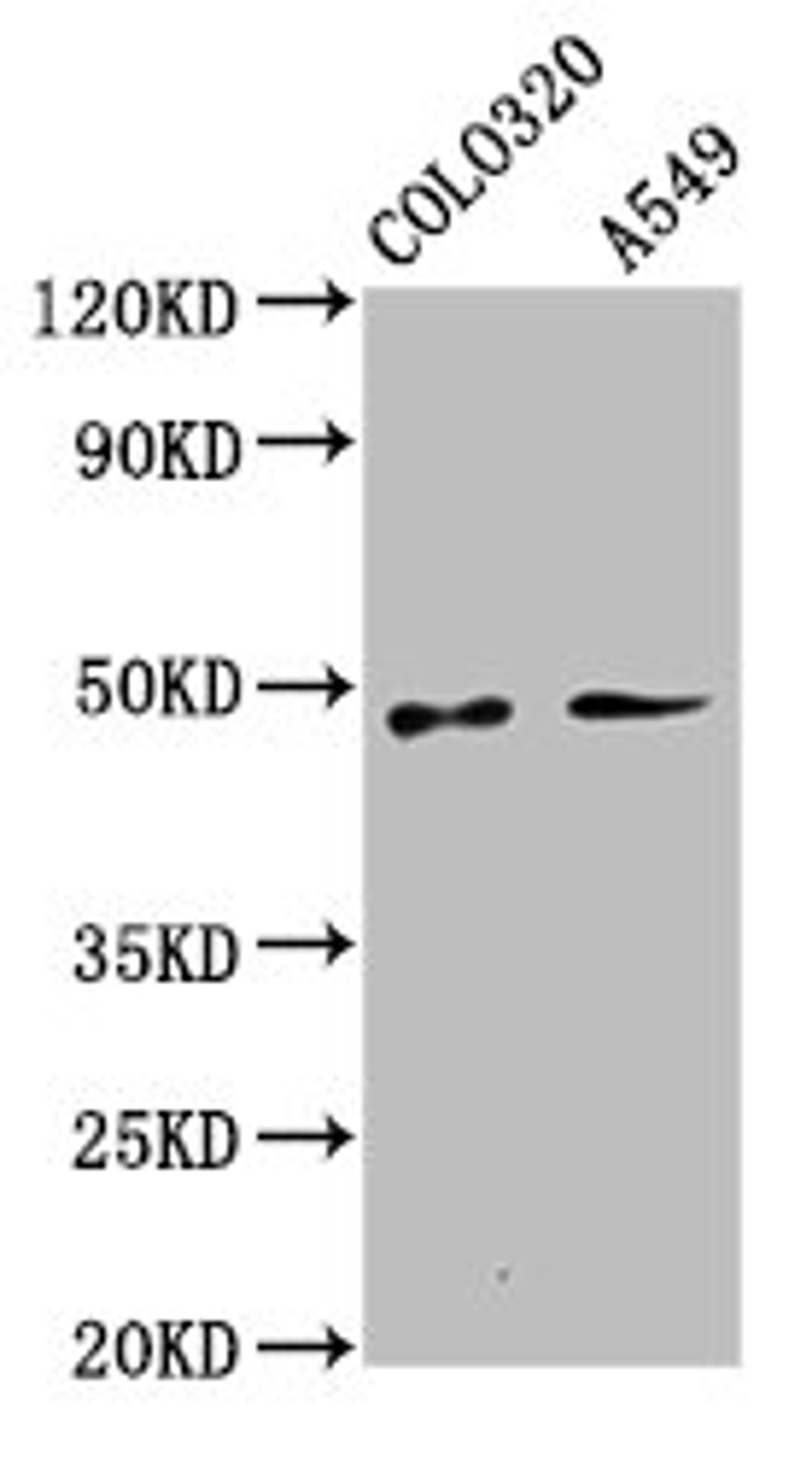 Western Blot. Positive WB detected in: Colo320 whole cell lysate, A549 whole cell lysate. All lanes: PNPLA5 antibody at 3.1µg/ml. Secondary. Goat polyclonal to rabbit IgG at 1/50000 dilution. Predicted band size: 48, 36 kDa. Observed band size: 48 kDa